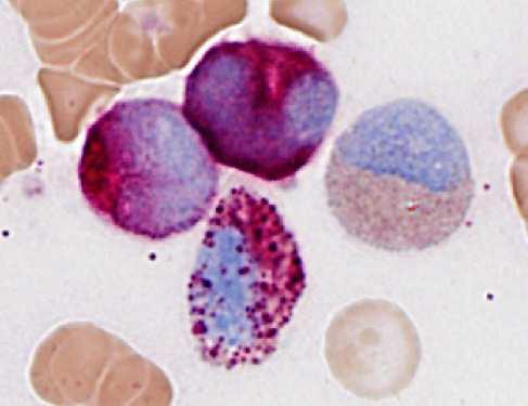 positieve cellen, behorend tot de neutrofiele myeloïde reeks ANAE positieve cel, behorend tot de monocytaire reeks