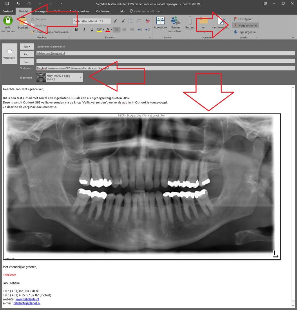 2.2 Verzenden van ZorgMail vanuit Outlook In Outlook kan een add-in worden gemaakt die een speciale ZorgMail knop plaatst op de taakbalk van Outlook. Zie daartoe de PDF op de ZorgMail website.