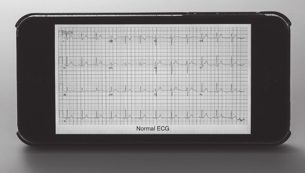 VERRIJKINGSSTOF thema 3 De bloedsomloop Afb. 45 ECG op smartphone In 2012 is een onderzoek uitgevoerd met een ECG-apparaat dat verbonden aan een smartphone hartfilmpjes kan maken.