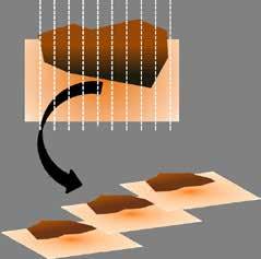 Bij WIFSA wordt het preparaat in verticale richting in fragmenten gelamelleerd (vandaar de naam bread loaf ), waarna vriescoupes van deze lamellen door de patholoog worden beoordeeld (figuur 1 b).