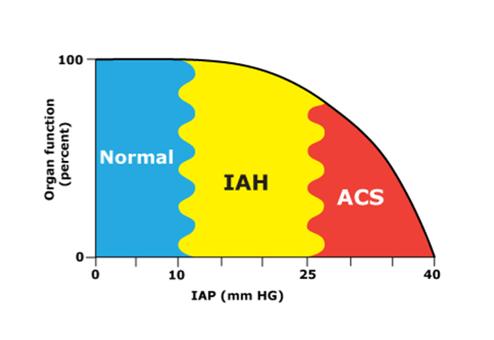 Begrippen IAP = intra abdominale pressure. Druk in de buikholte.