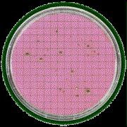 waarschijnlijk ook verontreinigd met pathogene bacteriën en virussen of andere