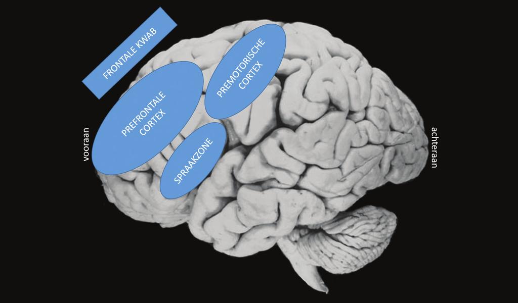 Belangrijk is dat bij primair progressieve afasie non-fluente variant, veel gebieden in de hersenen gespaard blijven.