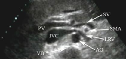 arterieën v.