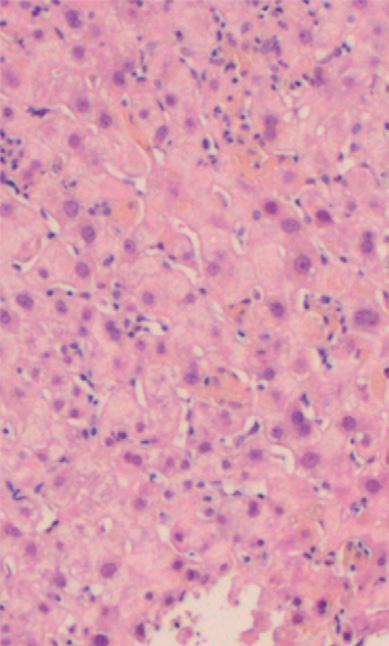 histiocyten werden gezien, evenals plasmacellen, segmentkernige cellen en eosinofiele granulocyten. Tevens was er sprake van bilirubinostase (HE-kleuring, microscopische vergroting: 200 x).