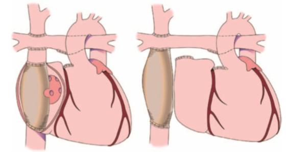 Fontan anatomie Jolley et al.