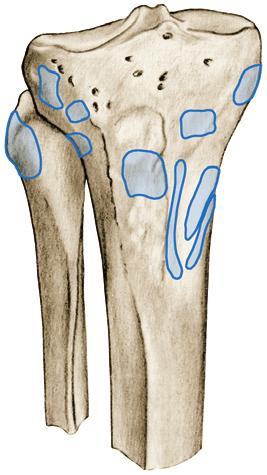 Kniegewrichtsspieren 5 7.Ga,b Dijbeenspieren (kniegewrichtsspieren), aanhechting op tibia en fibula. 0 M.