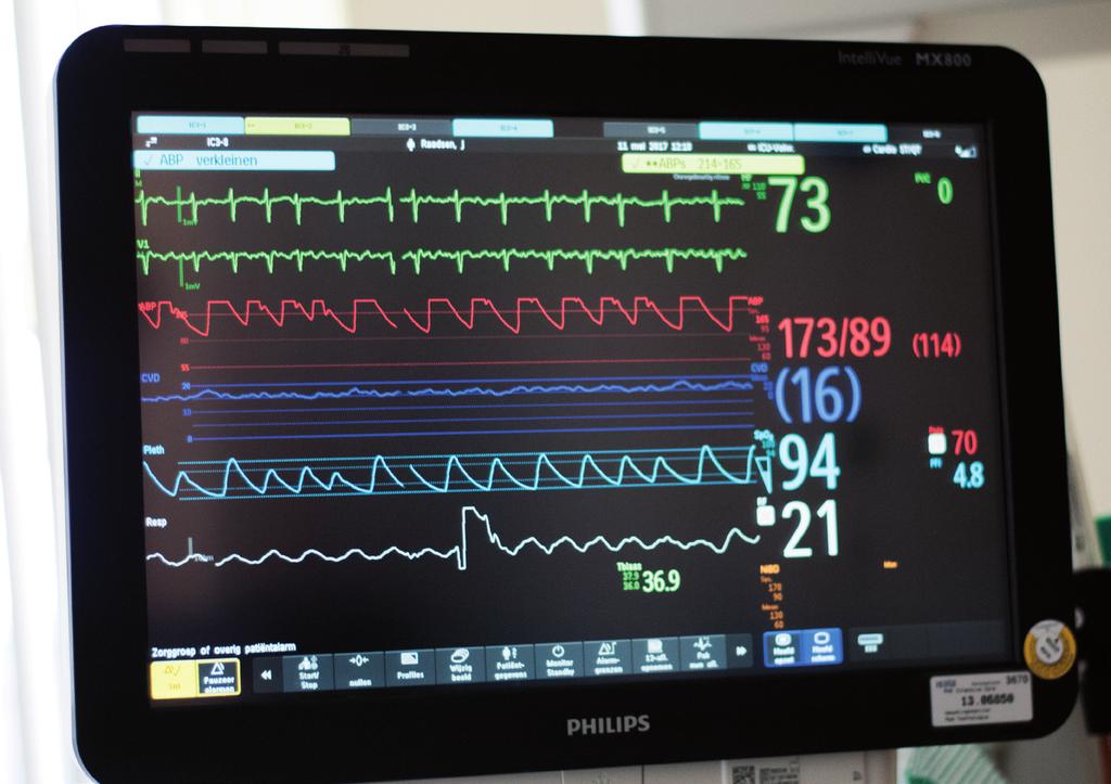 Monitor Naast het bed van Suus hangt een klein computerschermpje; dit noemen we de monitor. Op de monitor zie je verschillende lijnen en cijfers bewegen. Ze hebben allemaal een andere kleur.