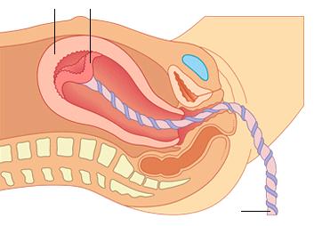 Nageboortetijdperk Als uw kindje geboren is, moet de placenta nog uit de baarmoeder. De baarmoeder trekt dan samen om de placenta los te maken en om te voorkomen dat u veel bloed verliest.