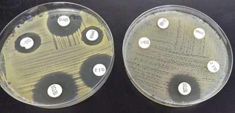 Campylobacter coli &