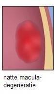 macula Afbeelding 2: