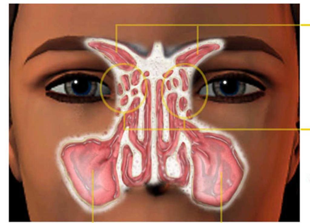 U bent onder behandeling bij de keel-, neus- en oorarts (KNO-arts) voor uw ontsteking aan de bijholten van uw neus.