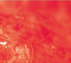 beeld: Paul de Vos Elf kunstmatige alvleesklieren Immunoloog Paul de Vos onderzoekt de effectiviteit van een