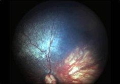 Collie Eye Anomalie: Aangeboren afwijking van het