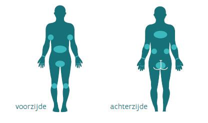 Wat zijn de symptomen? De schurftmijt nestelt zich bij voorkeur tussen de vingers, buitenkant van de polsen, onder de oksels, onder de borsten, rond de navel, op de voetzolen en op de geslachtdelen.