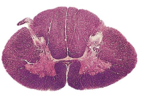 Funiculus Fissuracommunicans mediana Ramus albus Ruggenmerg en spinale zenuwen 2 Ramus communicans griseus Sulcus 4.79a c Dwarsdoorsnede van het ruggenmerg (medulla spinalis).