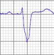 Het ECG: wat meten we?