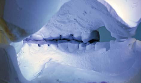 Als je naar een patiënt met een sterk afgesleten dentitie kijkt, is het handig om deze basisgegevens voor de esthetiek mee te nemen. Daarvoor zijn foto s een handig hulpmiddel.