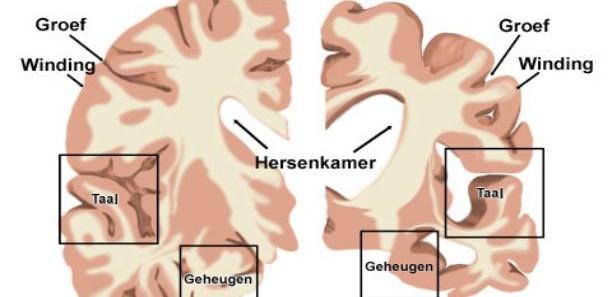 Geheugenstoornissen Inprenting - herhalen Herinnering Leren