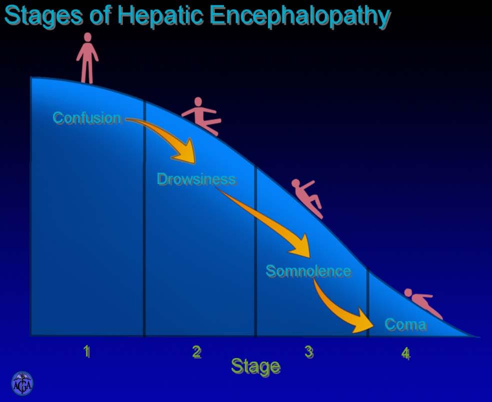 12 figuur 12 stadia van Hepatische Encephalopathie In figuur 12 zijn de volgende stadia te zien: Confusion