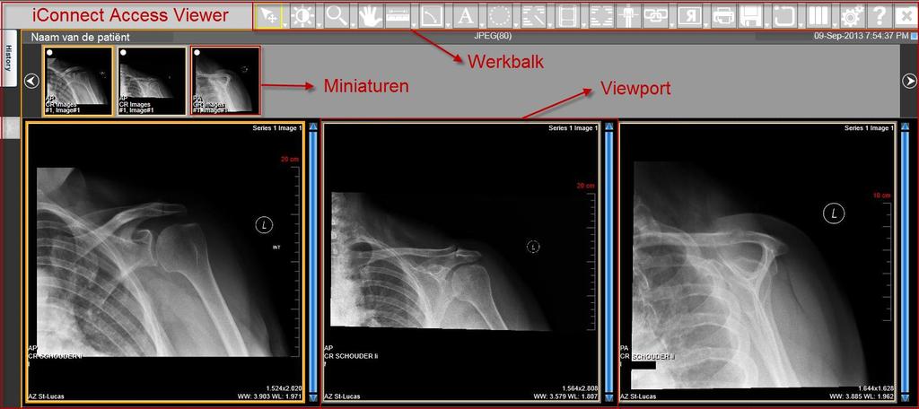 iconnect Access gebruikershandleiding Korte omschrijving iconnect Access is een zero-client viewer ontworpen om verwijzende artsen en chirurgen toegang te geven tot beelden en rapporten om hen te