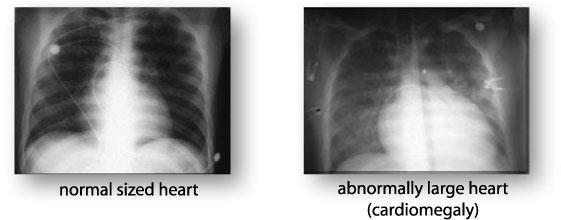 X-thorax