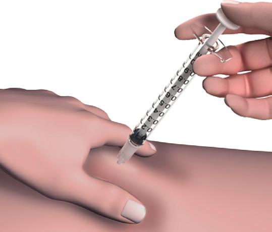 Strensiq injecteren 10 Knijp de huid van de gekozen injectieplaats zacht tussen uw duim en uw wijsvinger samen.