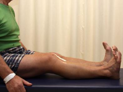 1 Oefenprogramma na knieprothese Vanaf de dag na de operatie worden oefeningen 1 t.e.m. 3 aangeleerd door de kinesist(e).