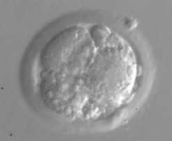 dag 3 of dag 5 Aantal embryo s