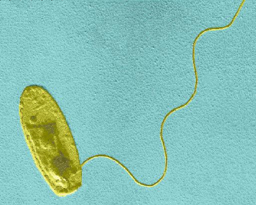 Besmetting met Legionella Legionella kan zich verspreiden via aërosolen Aërosolen worden ingeademd en komen in de longen In de longen kan de