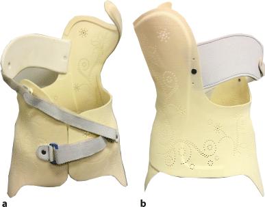M brace, met flexibelere onderdelen en de sluiting aan de voorzijde (fig. 6). Er is tien jaar aan dit corset gewerkt en er wordt nu ook een 3D-printversie van ontwikkeld.