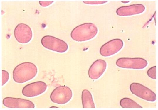 Horizontaal: Elliptocytose Membraan