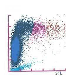 Reticulocyt en hemoglobine flux Erythrocyten Reticulocyten Cel grootte (hemoglobine inhoud