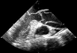 Diagnostiek Technieken om de aorta te onderzoeken Het diagnostisch proces begint met het bezoek aan de arts en het lichamelijk onderzoek.