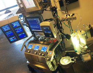 Therapie Technische benodigdheden voor chirurgie Hart-Long machine Operaties aan de aorta ascendens en aorta boog worden uitgevoerd met een hart-long machine.