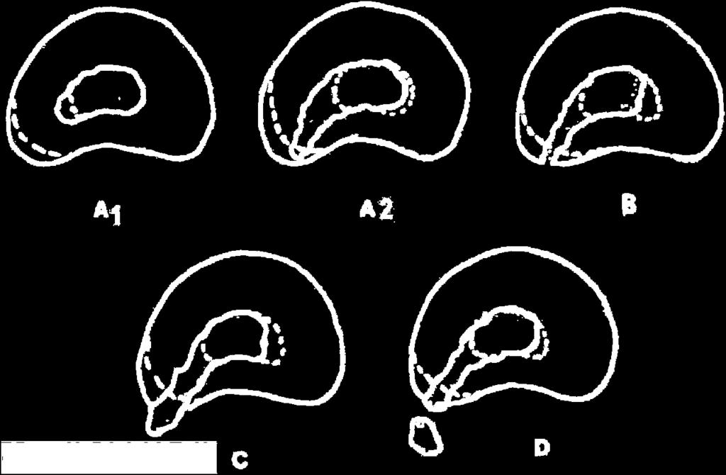 discus te verplaatsen (figuur 10). Figuur 10. MRC verplaatsingen tijdens HNP links dorsolateraal.