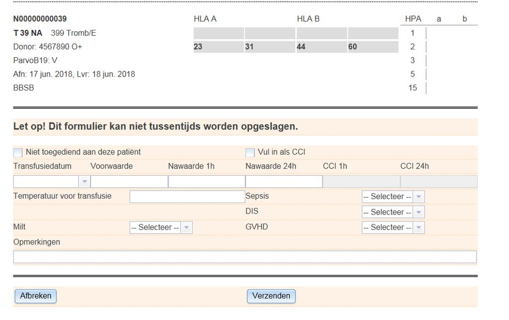 Voorbeeld zoals nu voor