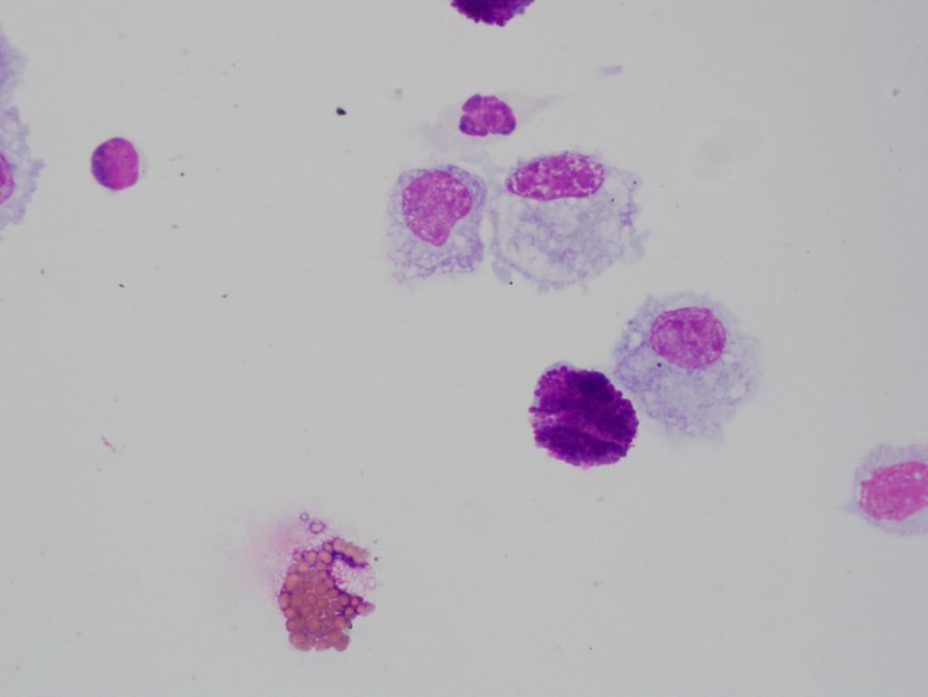 lymfocyt macrofaag