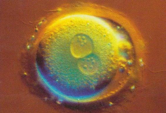 Het begin van een mens, het eerste stadium van een bevruchte eicel. De kern van de spermacel en de kern van de eicel smelten samen. Dit is de bevruchting.