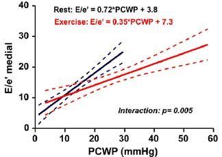 X-TTE als tussenstap E/e @ex correleerde het beste met PCWP@ex E/e @ex >14: sensitiviteit 80%,