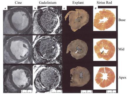 Histologische basis LGE