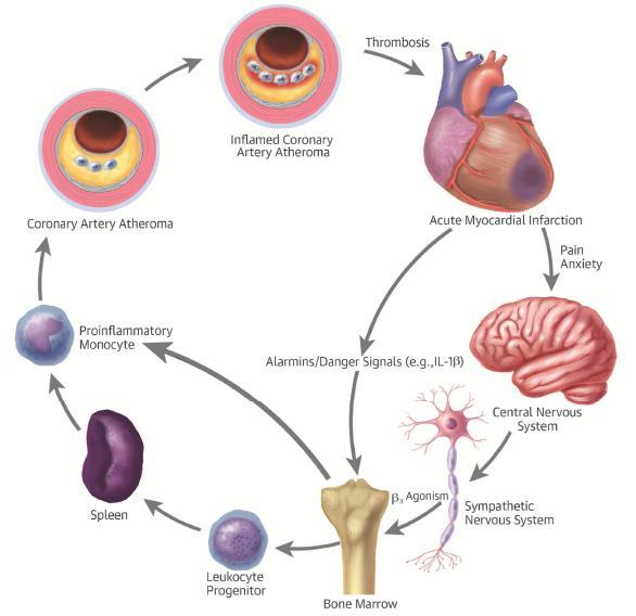 Systemic inflammation