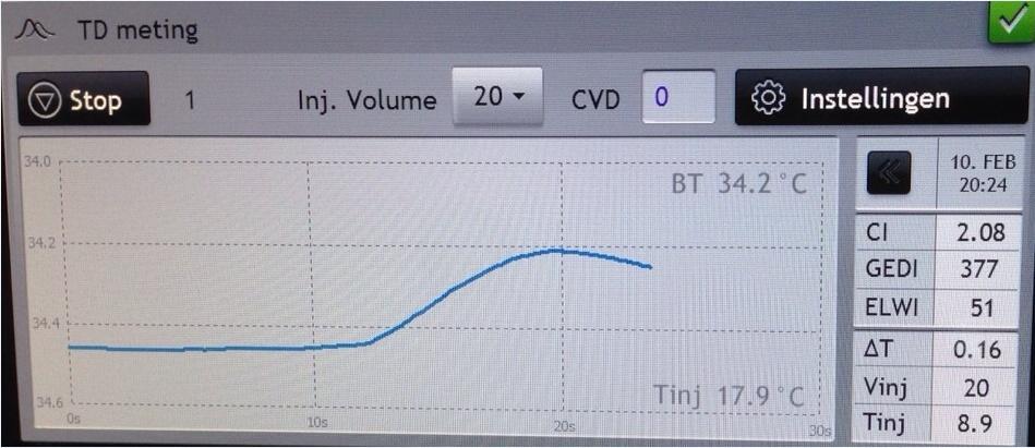 ELWI IJken 20 cc 7 seconden ΔT Controle Kalibratie Bron: V.