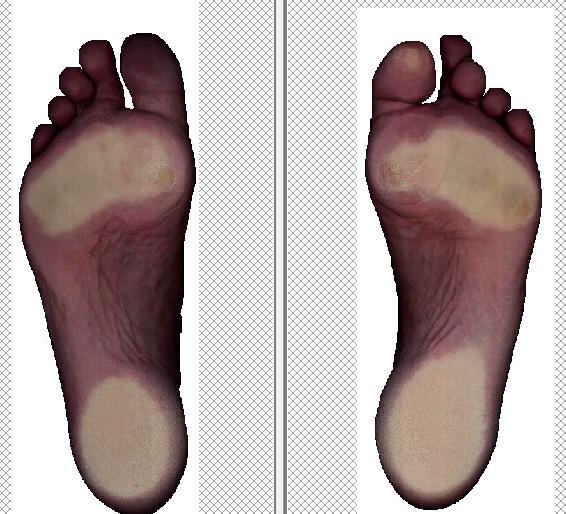 voet scan