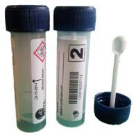 Verandering fecesdiagnostiek De TFT (triple feces test) afname set is vervangen door de DFT (dual feces test) afname set. Deze aanpassing in de fecesdiagnostiek van Lab- 3.