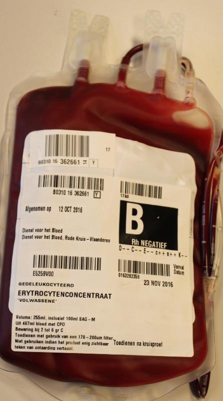 Transfusie van bloedproducten Bij een transfusie worden bloedproducten (rode bloedcellen, plasma of bloedplaatjes), afkomstig van een donor, toegediend aan een patiënt.