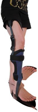 Accessoires Voor de verzorging van patïenten die naast een knie hyperextensie ook een voetheffer parese hebben kan de ToeOFF 2.0 met de COMBO componenten gecombineerd worden.