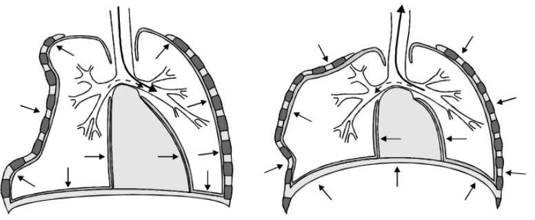 Fladderthorax Paradoxale thoraxwand bewegingen Veranderde respiratoire mechanismen