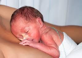 Ongunstige geboorte-uitkomsten in Suriname POPZiS 2013 Prevalentie: 17,5% 4% sterfte rondom zwangerschap en geboorte