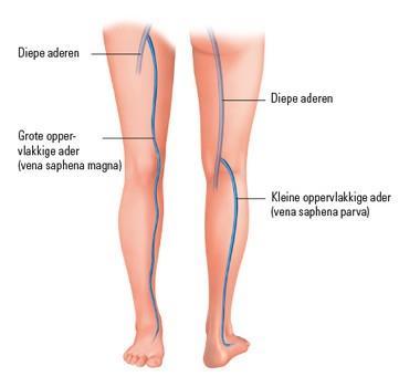 Fig. 2 : De vena safena magna en vena safena parva zijn de belangrijkste oppervlakkige aders in de benen. Wist je dit?